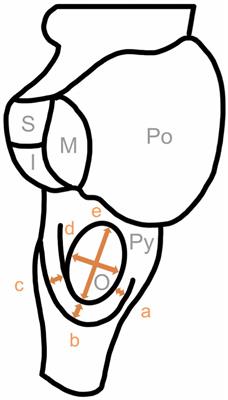 A morphometric analysis of the circumolivary fiber bundle of the human brainstem